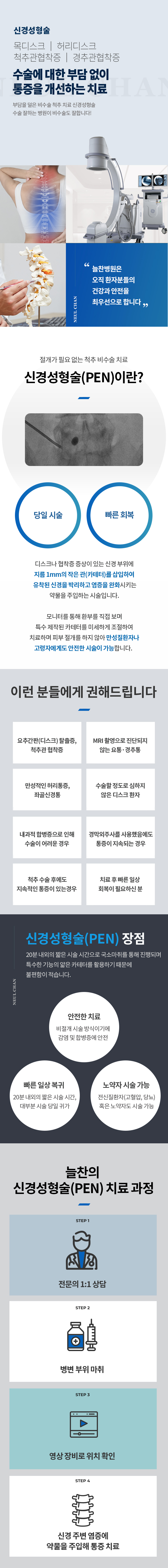 신경성형술