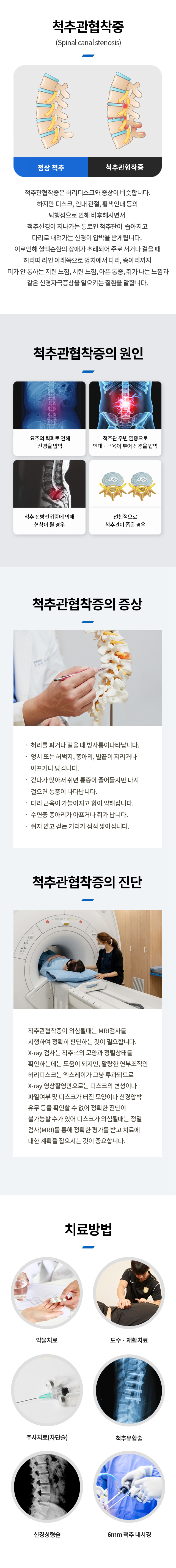 척추관협착증