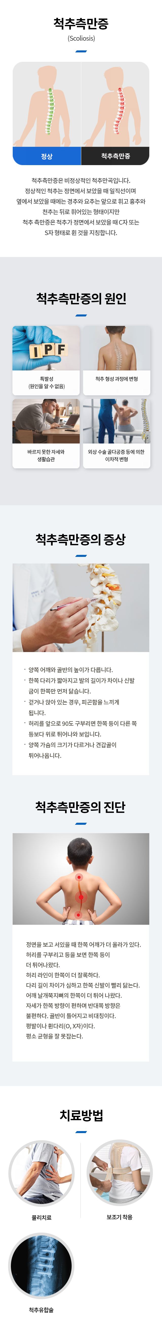 척추측만증