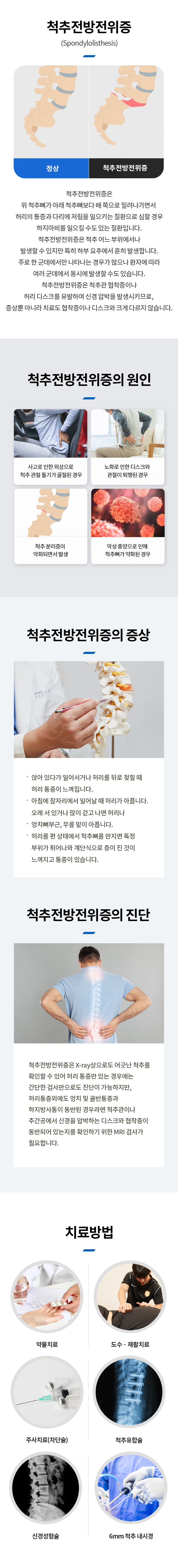 척추전방전위증