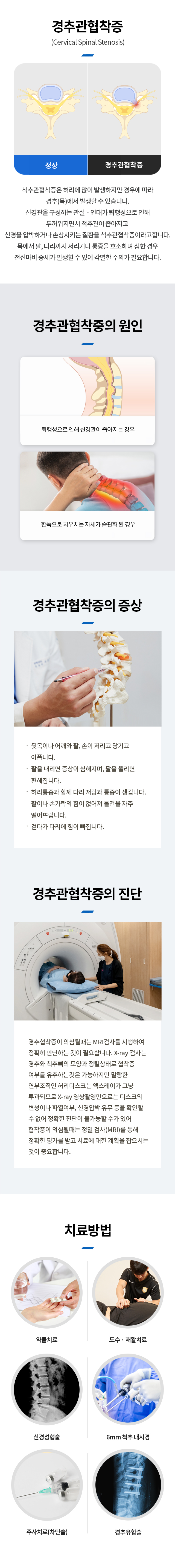 경추관협착증