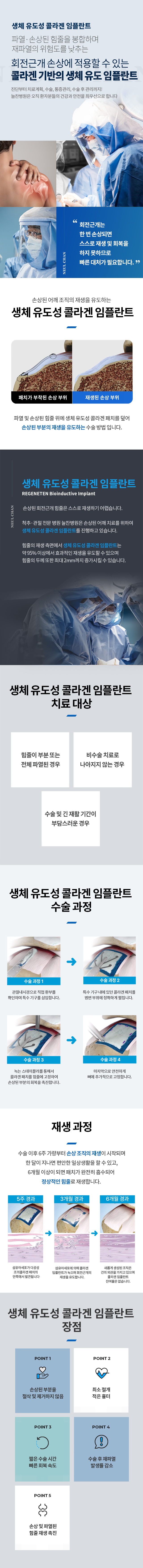 생체유도성콜라겐임플란트